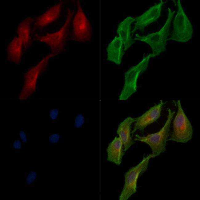 LACTB2 Antibody in Immunocytochemistry (ICC/IF)