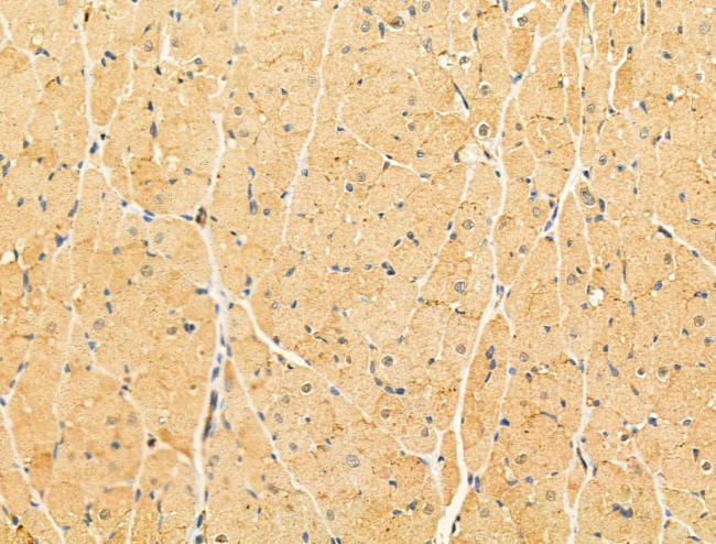 LACTB2 Antibody in Immunohistochemistry (Paraffin) (IHC (P))