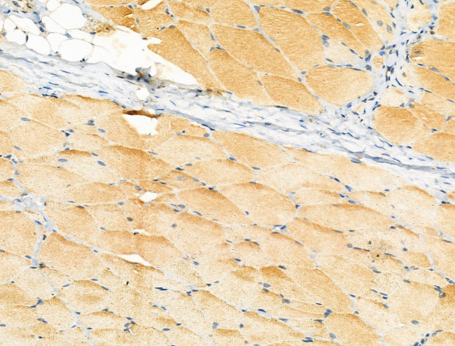 LACTB2 Antibody in Immunohistochemistry (Paraffin) (IHC (P))