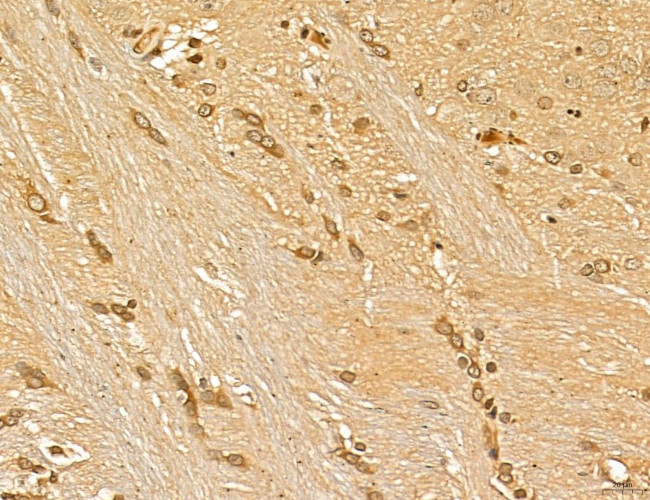 LAS1L Antibody in Immunohistochemistry (Paraffin) (IHC (P))