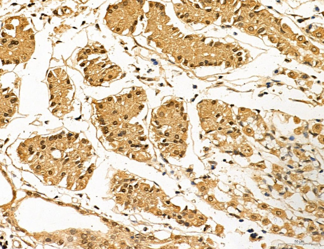 LAS1L Antibody in Immunohistochemistry (Paraffin) (IHC (P))