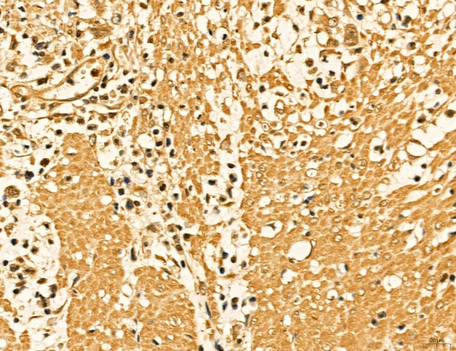 LAS1L Antibody in Immunohistochemistry (Paraffin) (IHC (P))