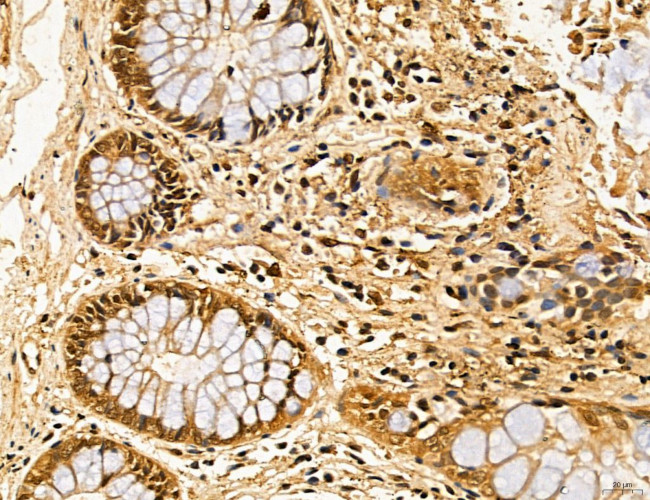 LAS1L Antibody in Immunohistochemistry (Paraffin) (IHC (P))