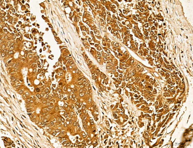 LAS1L Antibody in Immunohistochemistry (Paraffin) (IHC (P))