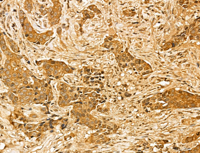 LAS1L Antibody in Immunohistochemistry (Paraffin) (IHC (P))