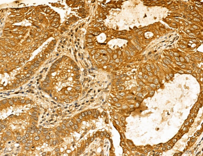 LAS1L Antibody in Immunohistochemistry (Paraffin) (IHC (P))