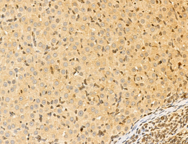 LAS1L Antibody in Immunohistochemistry (Paraffin) (IHC (P))