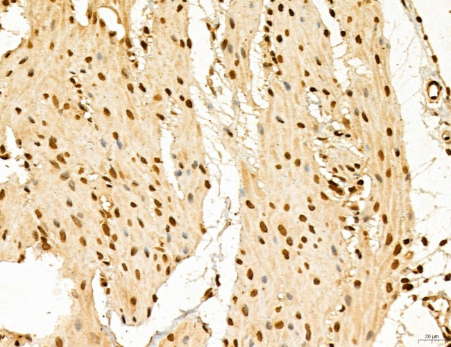 LAS1L Antibody in Immunohistochemistry (Paraffin) (IHC (P))