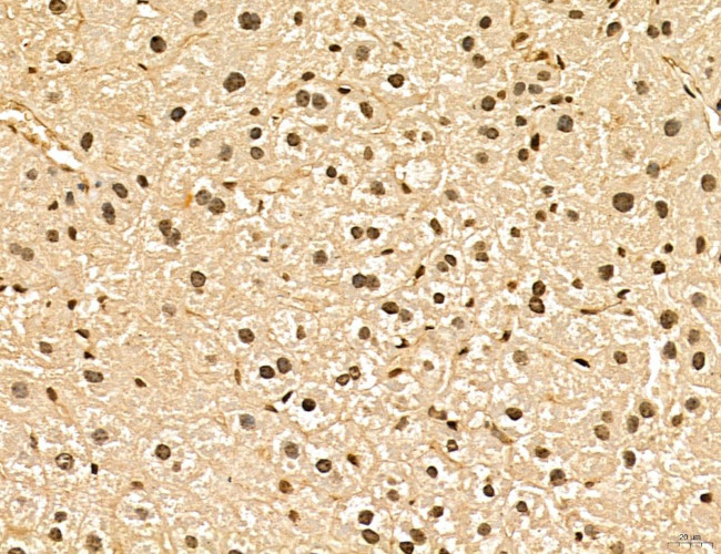 LAS1L Antibody in Immunohistochemistry (Paraffin) (IHC (P))