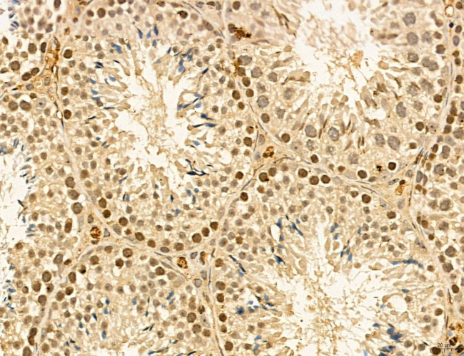 LAS1L Antibody in Immunohistochemistry (Paraffin) (IHC (P))