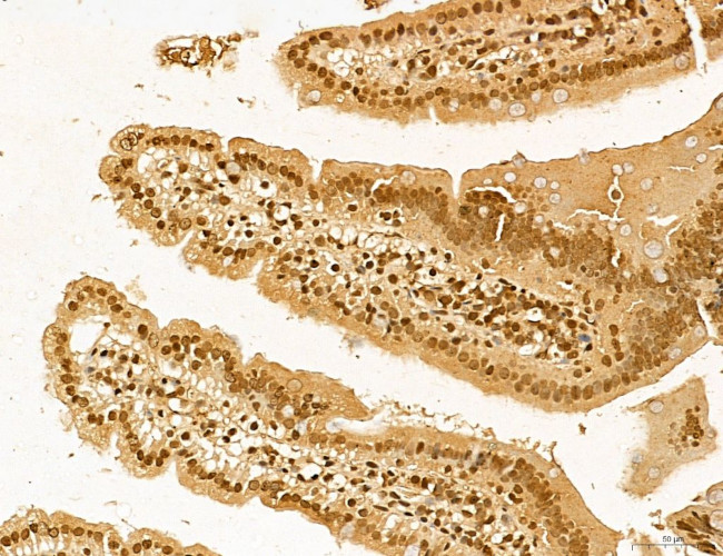 LAS1L Antibody in Immunohistochemistry (Paraffin) (IHC (P))