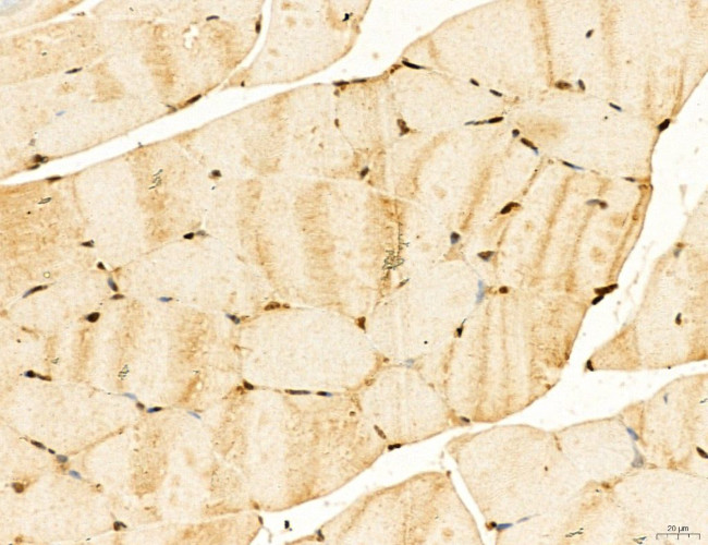 LAS1L Antibody in Immunohistochemistry (Paraffin) (IHC (P))