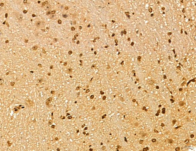 LAS1L Antibody in Immunohistochemistry (Paraffin) (IHC (P))