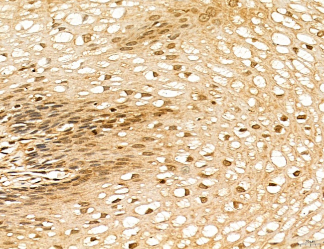 LAS1L Antibody in Immunohistochemistry (Paraffin) (IHC (P))