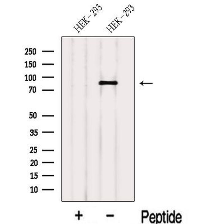 LAS1L Antibody in Western Blot (WB)