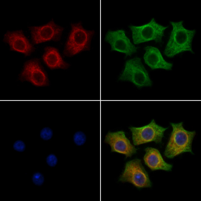 MAP1LC3C Antibody in Immunocytochemistry (ICC/IF)