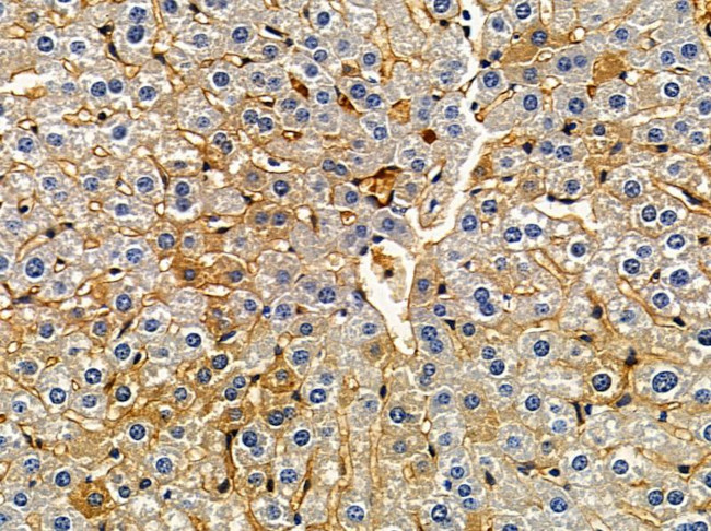 MAP1LC3C Antibody in Immunohistochemistry (Paraffin) (IHC (P))