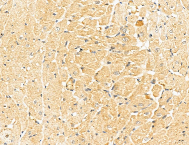 LOH12CR1 Antibody in Immunohistochemistry (Paraffin) (IHC (P))