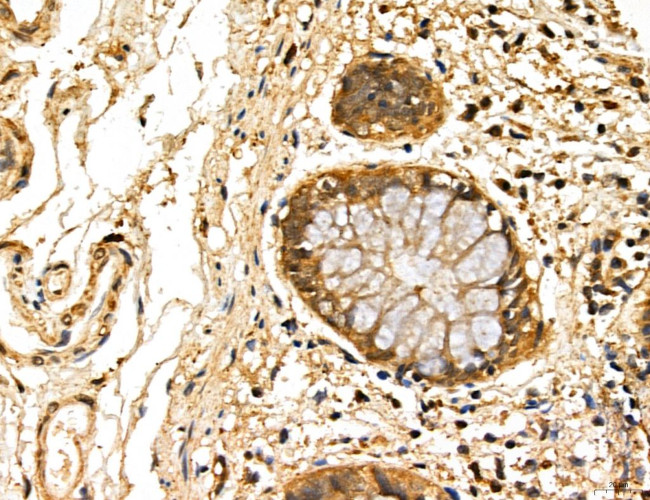 LOH12CR1 Antibody in Immunohistochemistry (Paraffin) (IHC (P))