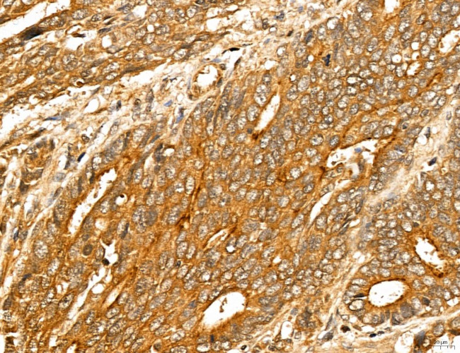 LOH12CR1 Antibody in Immunohistochemistry (Paraffin) (IHC (P))