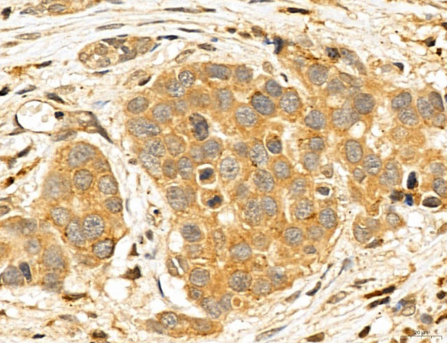 LOH12CR1 Antibody in Immunohistochemistry (Paraffin) (IHC (P))