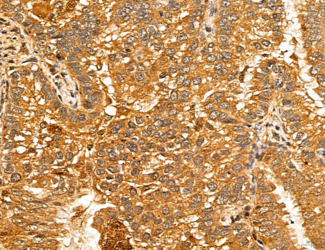 LOH12CR1 Antibody in Immunohistochemistry (Paraffin) (IHC (P))