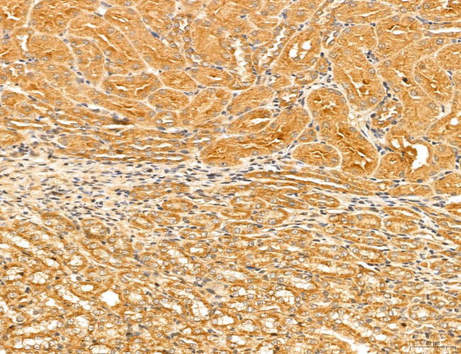 LOH12CR1 Antibody in Immunohistochemistry (Paraffin) (IHC (P))