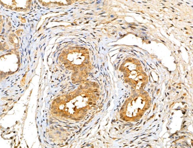 LOH12CR1 Antibody in Immunohistochemistry (Paraffin) (IHC (P))