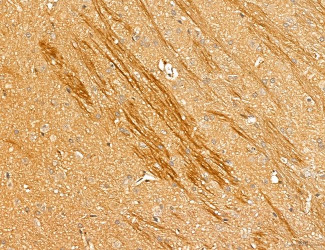 LOH12CR1 Antibody in Immunohistochemistry (Paraffin) (IHC (P))