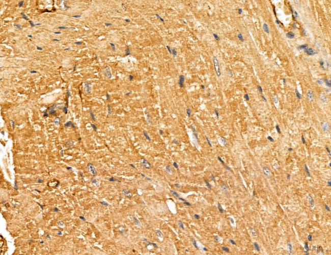 LOH12CR1 Antibody in Immunohistochemistry (Paraffin) (IHC (P))