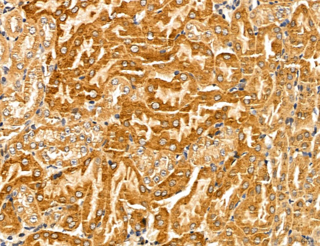 LOH12CR1 Antibody in Immunohistochemistry (Paraffin) (IHC (P))