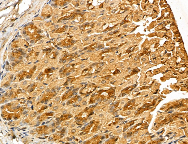 LOH12CR1 Antibody in Immunohistochemistry (Paraffin) (IHC (P))