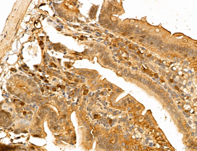 LOH12CR1 Antibody in Immunohistochemistry (Paraffin) (IHC (P))