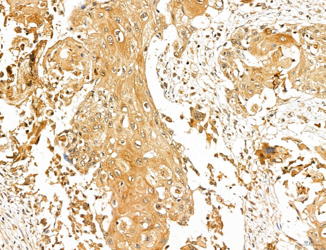 LOH12CR1 Antibody in Immunohistochemistry (Paraffin) (IHC (P))