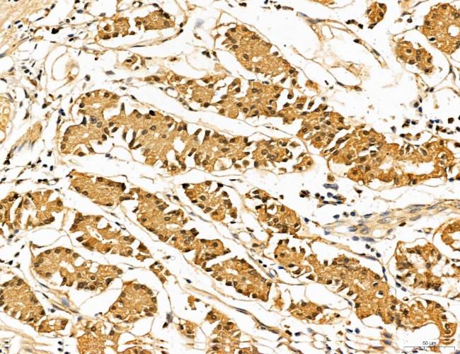 LOH12CR1 Antibody in Immunohistochemistry (Paraffin) (IHC (P))