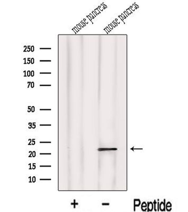 LOH12CR1 Antibody in Western Blot (WB)