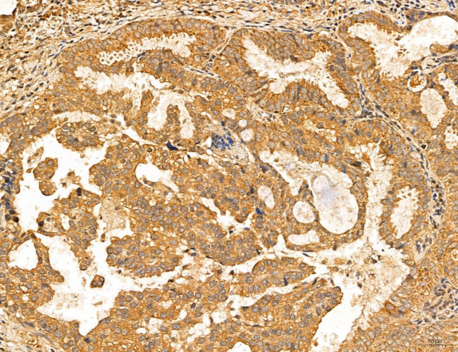 MAN1A2 Antibody in Immunohistochemistry (Paraffin) (IHC (P))