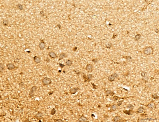 MAP1S Antibody in Immunohistochemistry (Paraffin) (IHC (P))