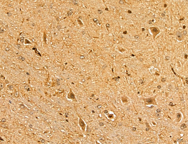 MAP1S Antibody in Immunohistochemistry (Paraffin) (IHC (P))