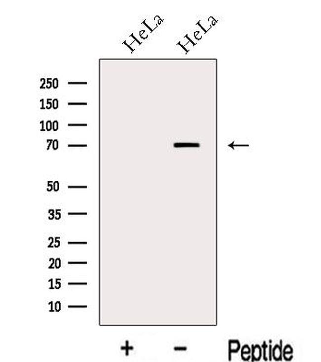 RKHD2 Antibody in Western Blot (WB)