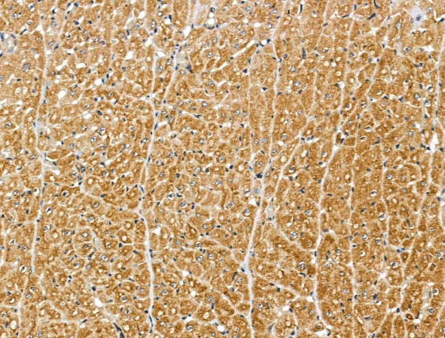 MIPEP Antibody in Immunohistochemistry (Paraffin) (IHC (P))