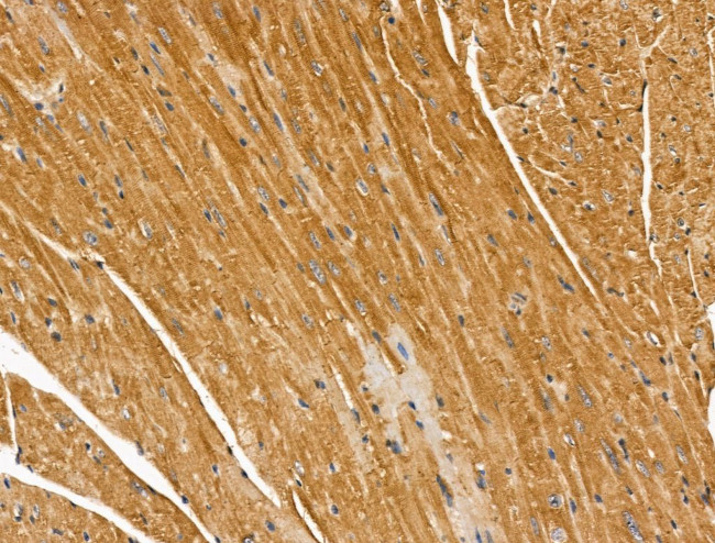 MIPEP Antibody in Immunohistochemistry (Paraffin) (IHC (P))