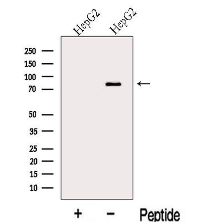 MIPEP Antibody in Western Blot (WB)