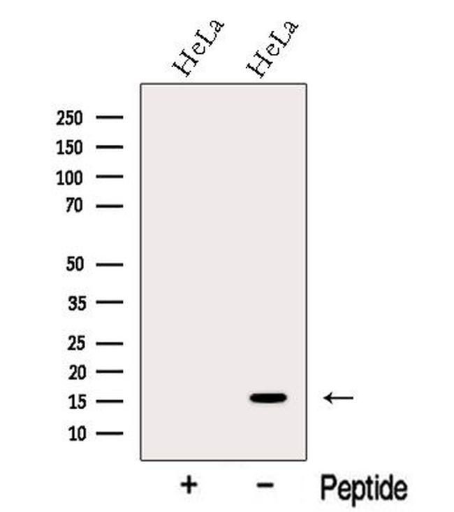 MMS2 Antibody in Western Blot (WB)