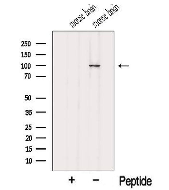 MYO1D Antibody in Western Blot (WB)