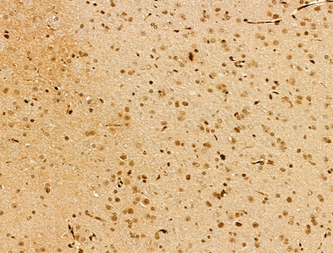 MYO1E Antibody in Immunohistochemistry (Paraffin) (IHC (P))