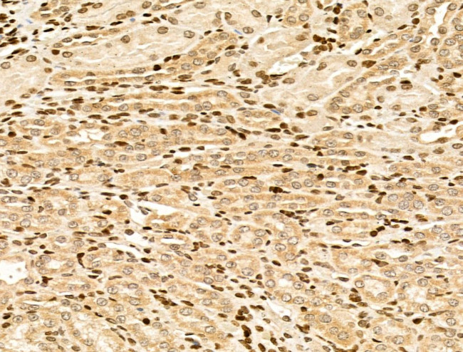 MYO1E Antibody in Immunohistochemistry (Paraffin) (IHC (P))