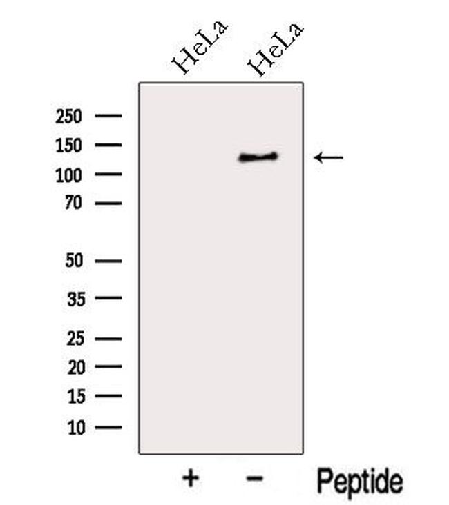 MYO1E Antibody in Western Blot (WB)