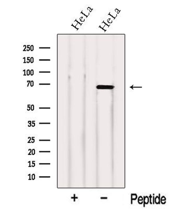 NCOA5 Antibody in Western Blot (WB)