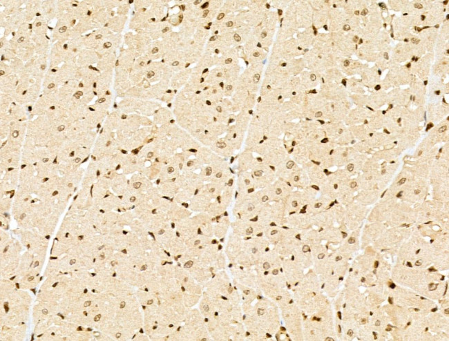 NCOA6 Antibody in Immunohistochemistry (Paraffin) (IHC (P))